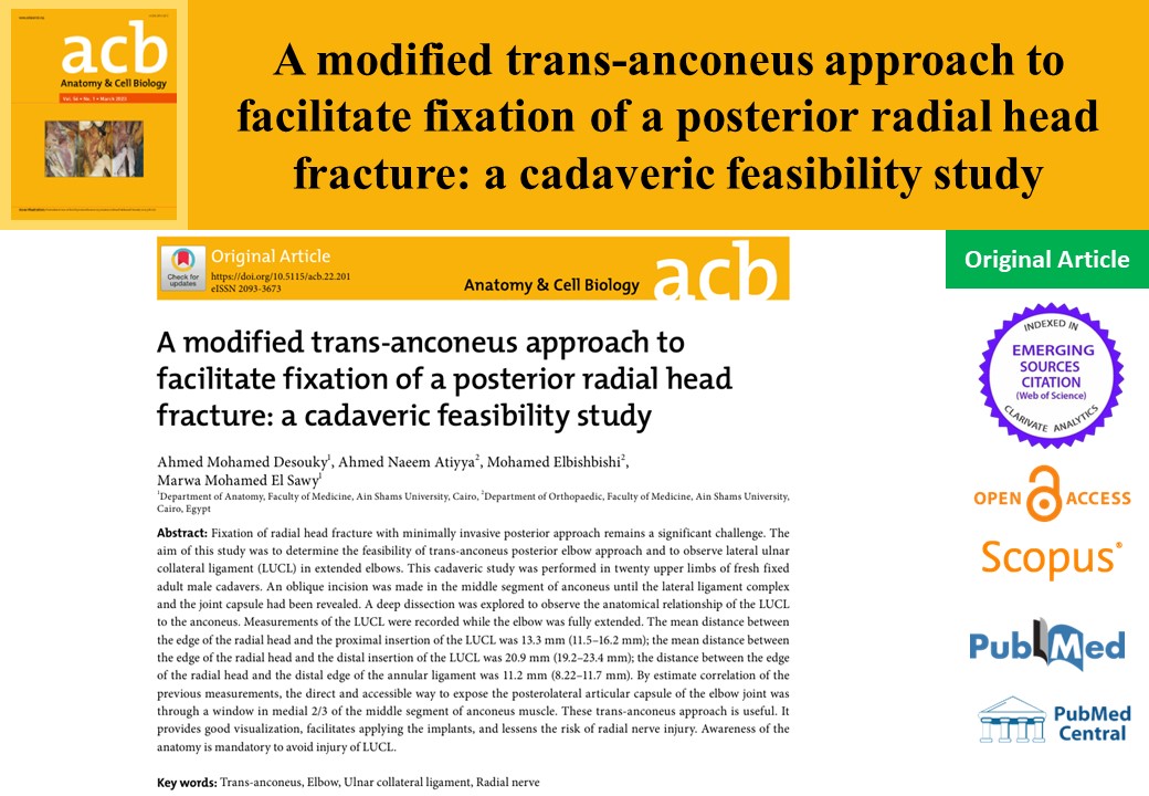 AcbjournalO's tweet photo. A modified trans-anconeus approach to facilitate fixation of a posterior radial head fracture: a cadaveric feasibility study

https://t.co/1LZ04t4ejk
Anat Cell Biol 2023; 56(1): 39-45

#대한해부학회 #AnatomyCellBiology
#Elbow #UlnarCollateralLigament #RadialNerve #TransAnconeus https://t.co/lt2IBllCjc