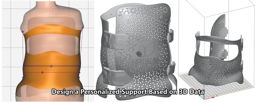 3DeVOK's tweet photo. How to help the 82-year-old teacher get better rehabilitation after spinal fracture surgery?
#iReal2E to scan the upper body;
Design the customized support;
Get the fitting support from @tpm3d;
Fix the wound location for 3 weeks.
#iReal3D #3dscanning #3dprinting #healthcare https://t.co/6oRFdWslHm