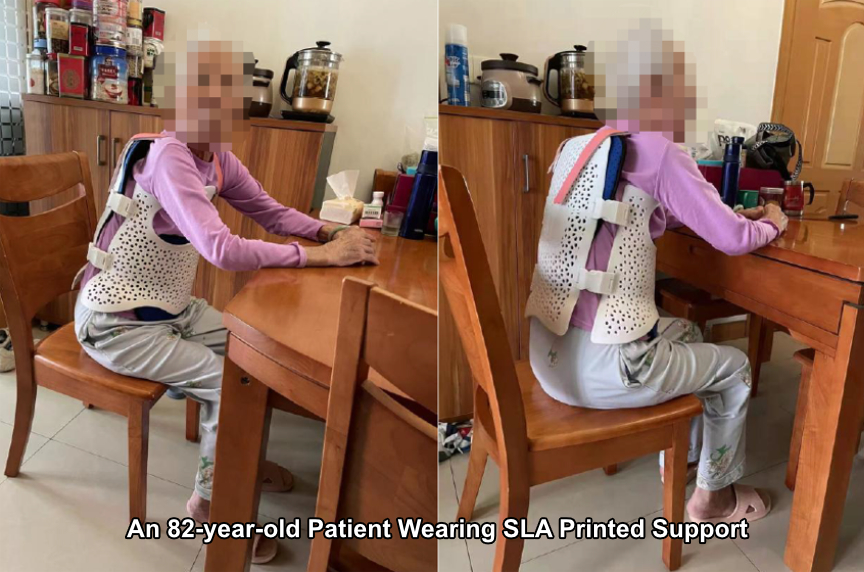3DeVOK's tweet photo. How to help the 82-year-old teacher get better rehabilitation after spinal fracture surgery?
#iReal2E to scan the upper body;
Design the customized support;
Get the fitting support from @tpm3d;
Fix the wound location for 3 weeks.
#iReal3D #3dscanning #3dprinting #healthcare https://t.co/6oRFdWslHm