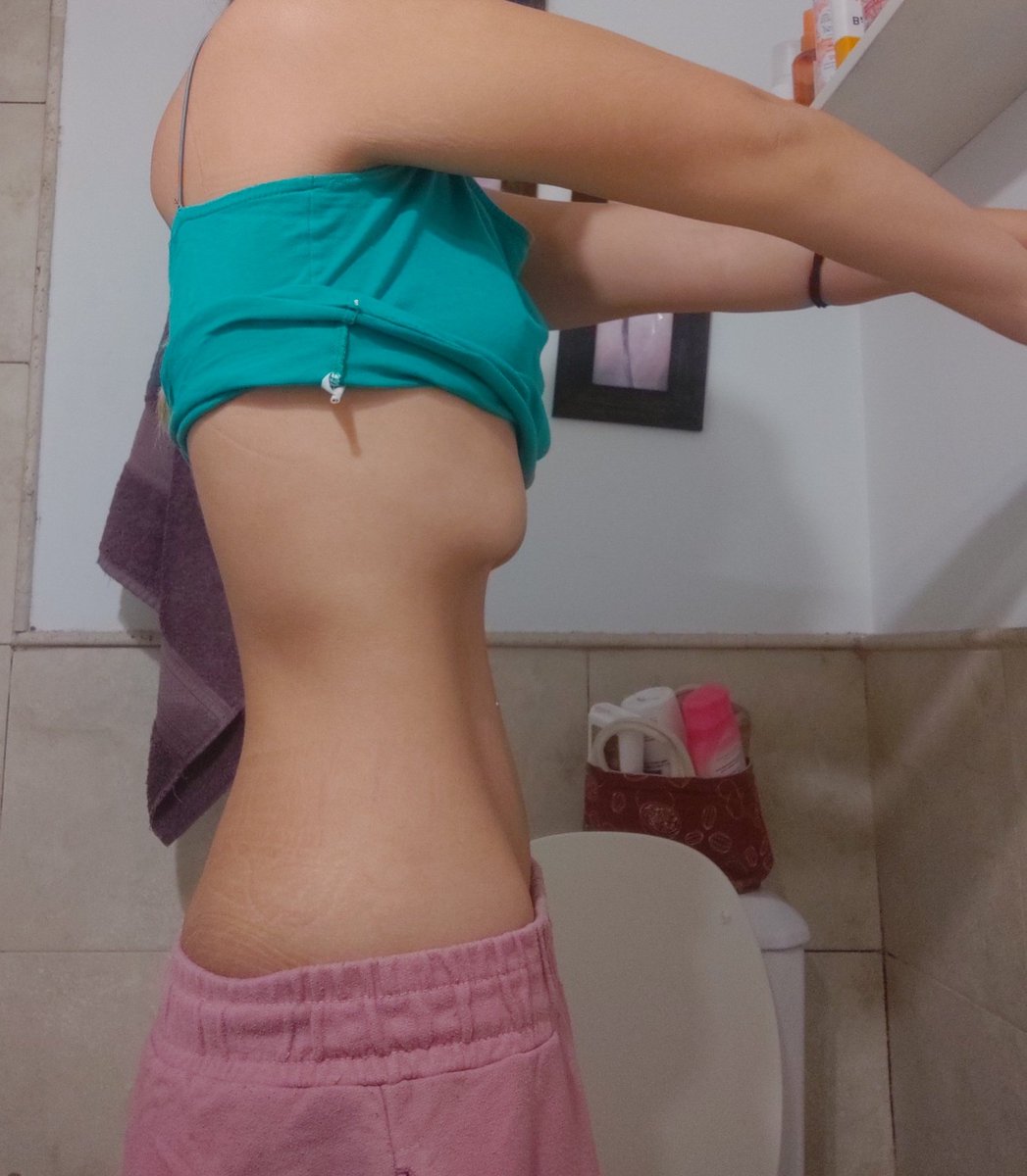 escorproblems tweet picture
