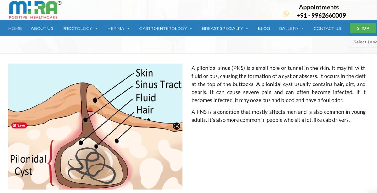 #pilonidalsinussinus #pilonidalsinustreatment #pilonidalsinus #MiraHealthCare
mirahealthcare.in/pilonidal-sinu…