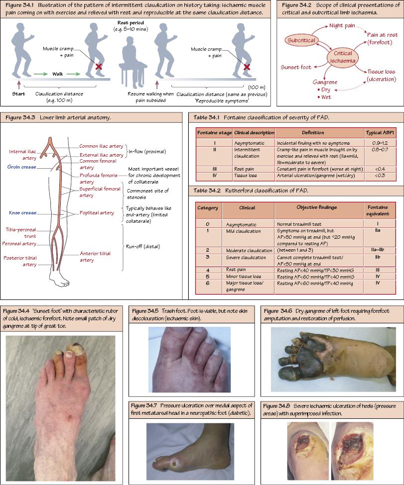 Sthanu On Twitter Peripheral Vascular Disease 