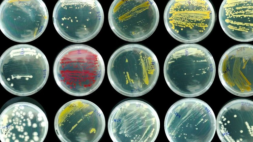 Alex Evenko - Greenapple (@evenkoalex) on Twitter photo Delighted to share that I'll be attending the <a href="/PGPRworkshop/">International PGPR Workshop</a> conference! and will present a poster on #biostimulants and Host Mediated Microbiome Enrichment #HMME in tomato. Excited to engage with experts in the field and connect with fellow students.
<a href="/minz_cytryn/">MinzCytryn Lab</a> Delighted to share that I'll be attending the <a href="/PGPRworkshop/">International PGPR Workshop</a> conference! and will present a poster on #biostimulants and Host Mediated Microbiome Enrichment #HMME in tomato. Excited to engage with experts in the field and connect with fellow students.
<a href="/minz_cytryn/">MinzCytryn Lab</a>