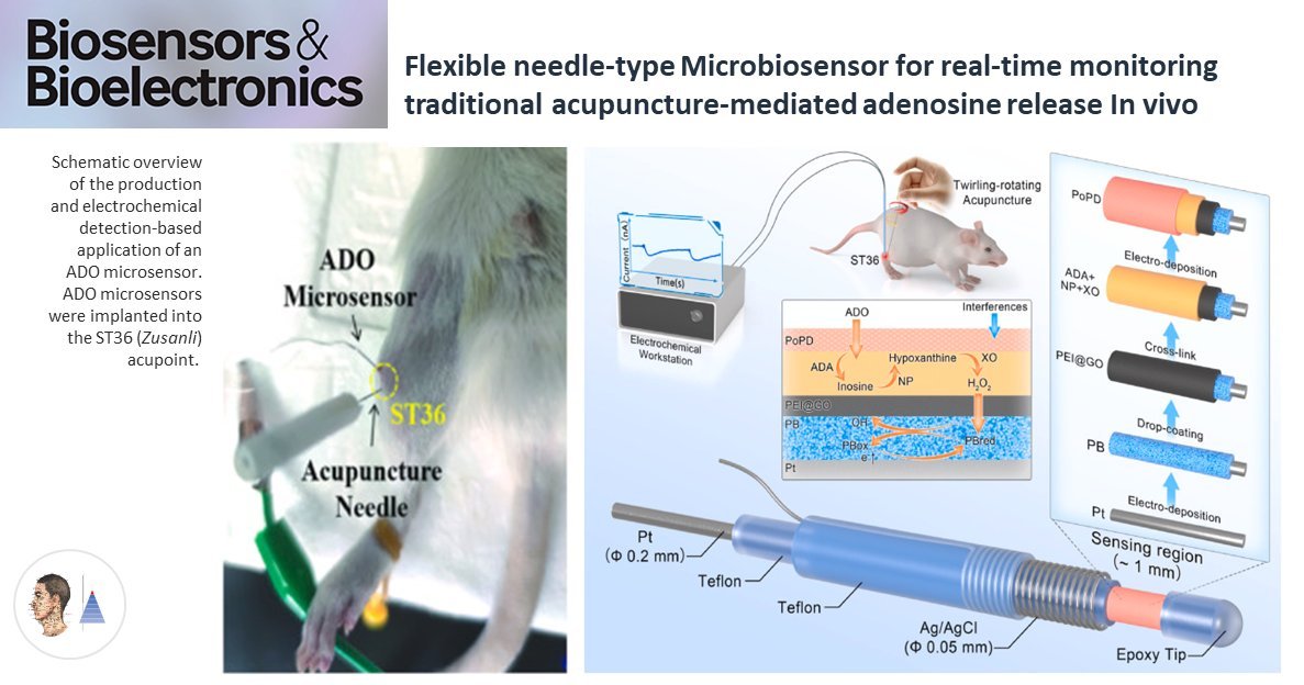 ⚪Technology 🇨🇳
📰Biosens Bioelectron (IF 𝟭𝟬.𝟲)
Development of a flexible microbiosensor for real-time measurement of adenosine release at the acupuncture point in response to different acupuncture needle stimulations.

pubmed.ncbi.nlm.nih.gov/37207583/
