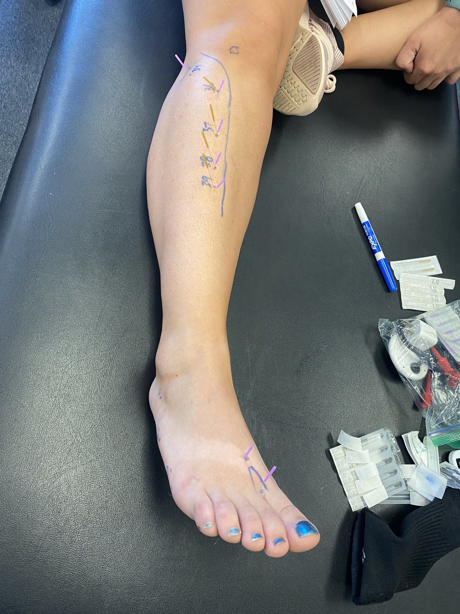 EPdrNate's tweet photo. DN-2 in Mile High Denver is complete! 30 PTs/ATCs/DCs are now #CertDN. @Pgagnondpt shows promise as the newest instructor for #AAMT! https://t.co/3IGVdQuUN4