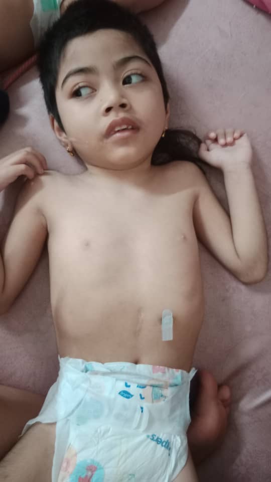 zumairaaa's tweet photo. Nama: Iman
Umur: 6 tahun 
Penyakit: Early Infantile Epileptic Encephalopathy (EIEE)

Sakit sejak umur 3 bulan punca sbb sawan tiba tiba. Skrg Iman makin kurus and kaki dia dah start bengkok &amp; keras, Dr suggest masukkan ke wad sbb nak pantau tapi family ada masalah duit skrg. https://t.co/bs6Qe1hM8Q