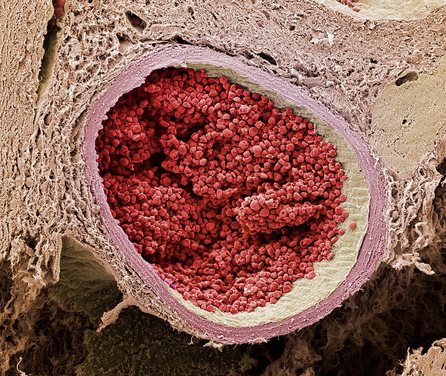 A section through a foetal aorta (the body's main artery) filled with red blood cells

Source :<a href="/microscopicture/">microscopic images.</a> 

#Science #MedTwitter #Cardiology #microscopy #scitwitter