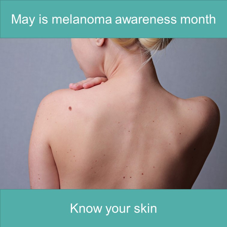It is important to check your moles throughout the year.
Regular mole mapping with Fotofinder can help monitor any changes.

Did you know?
You can develop melanoma even if you have never had skin damage
Melanoma is the 5th most common cancer in the UK