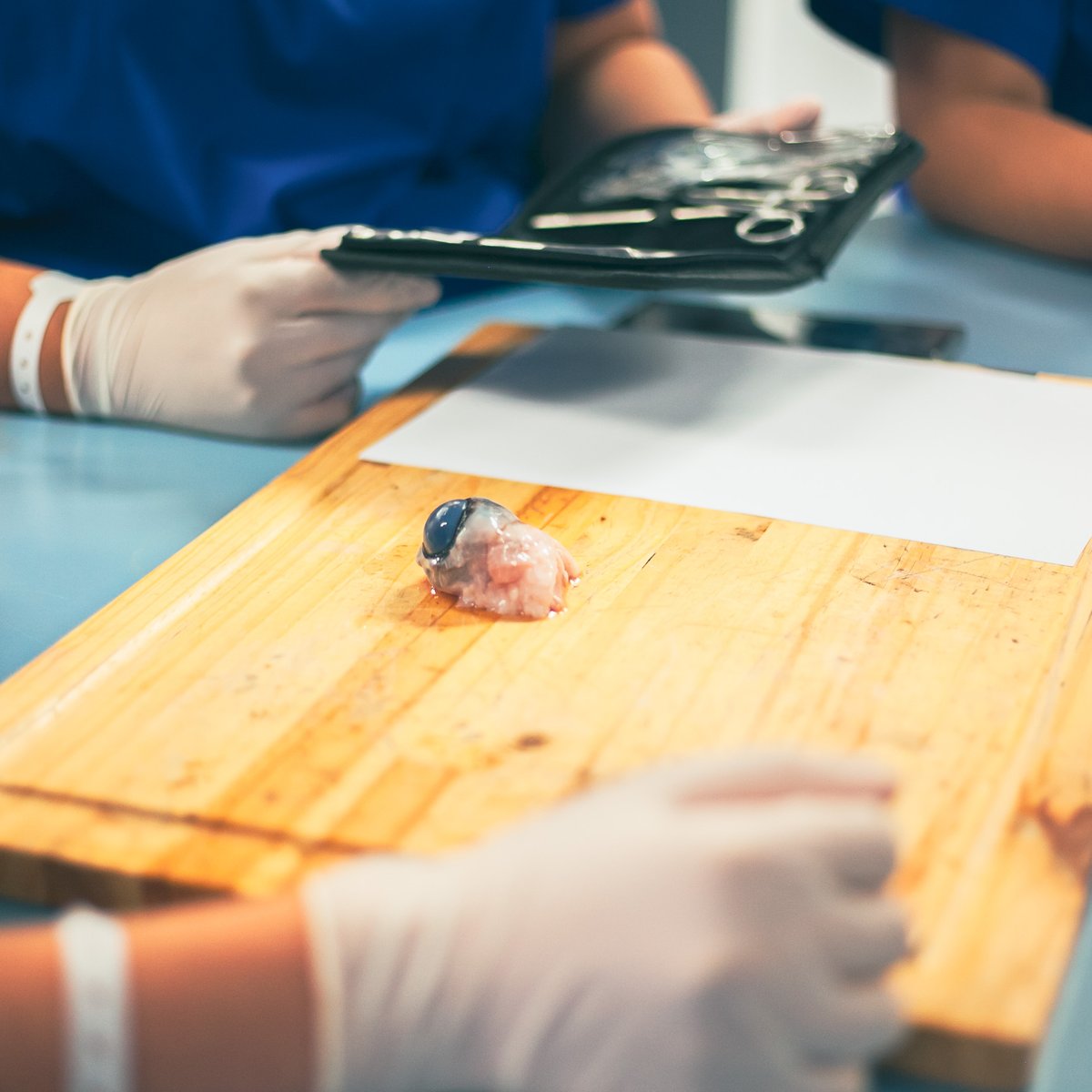 Multimedic's tweet photo. Dissecting a cow's eye for the first time can be a real challenge for students. Nevertheless, it's also lots of fun and a great chance to gain insights and hands-on experience. 

#theapprenticedoctor #medicalcamp #medicaltraining #futuredoctors #futurenurses #eyedissection https://t.co/vNU81PJRVI