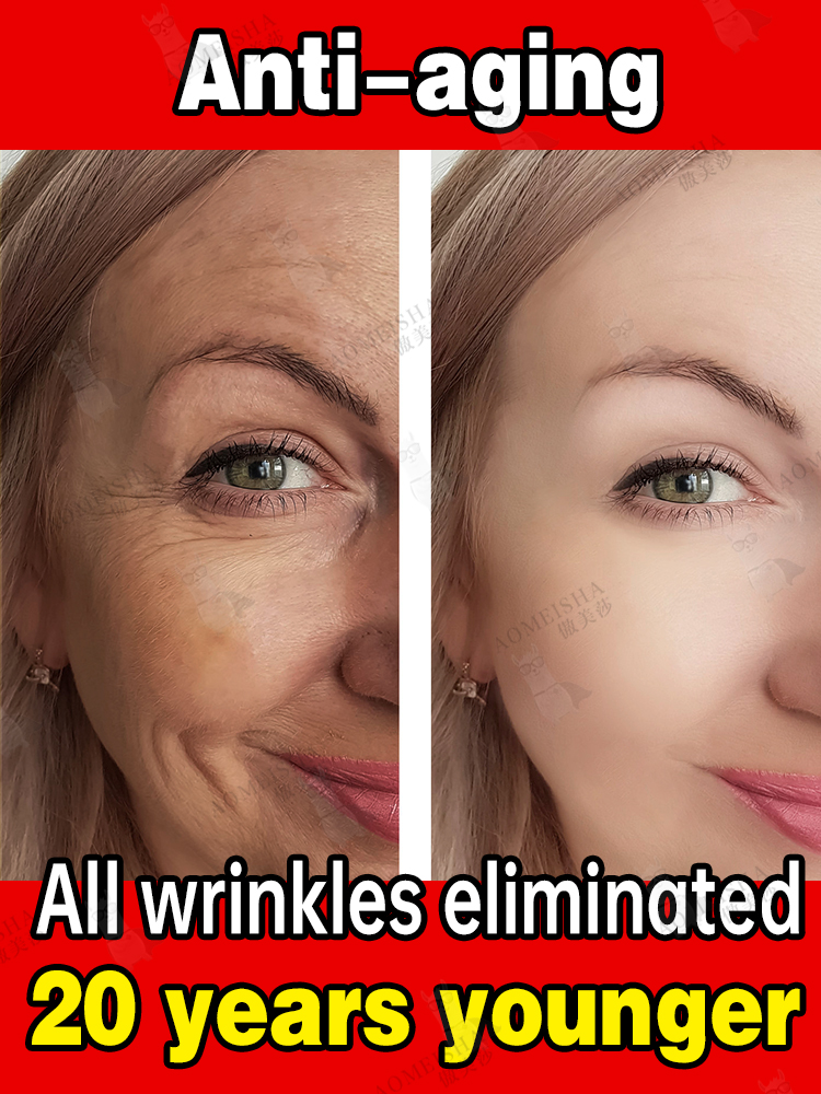 Say Goodbye to Fine Lines, Wrinkles, and Dark Circles with Our Anti-Aging Facial Cream bit.ly/43ie0JC 🛒🛍️
🛒📷 #FacialWrinkles #FineLines #DarkCircles #ForeheadWrinkles #NeckWrinkles #WrinkleRemover #AntiAging #Brightening #Firming #WhiteSkin