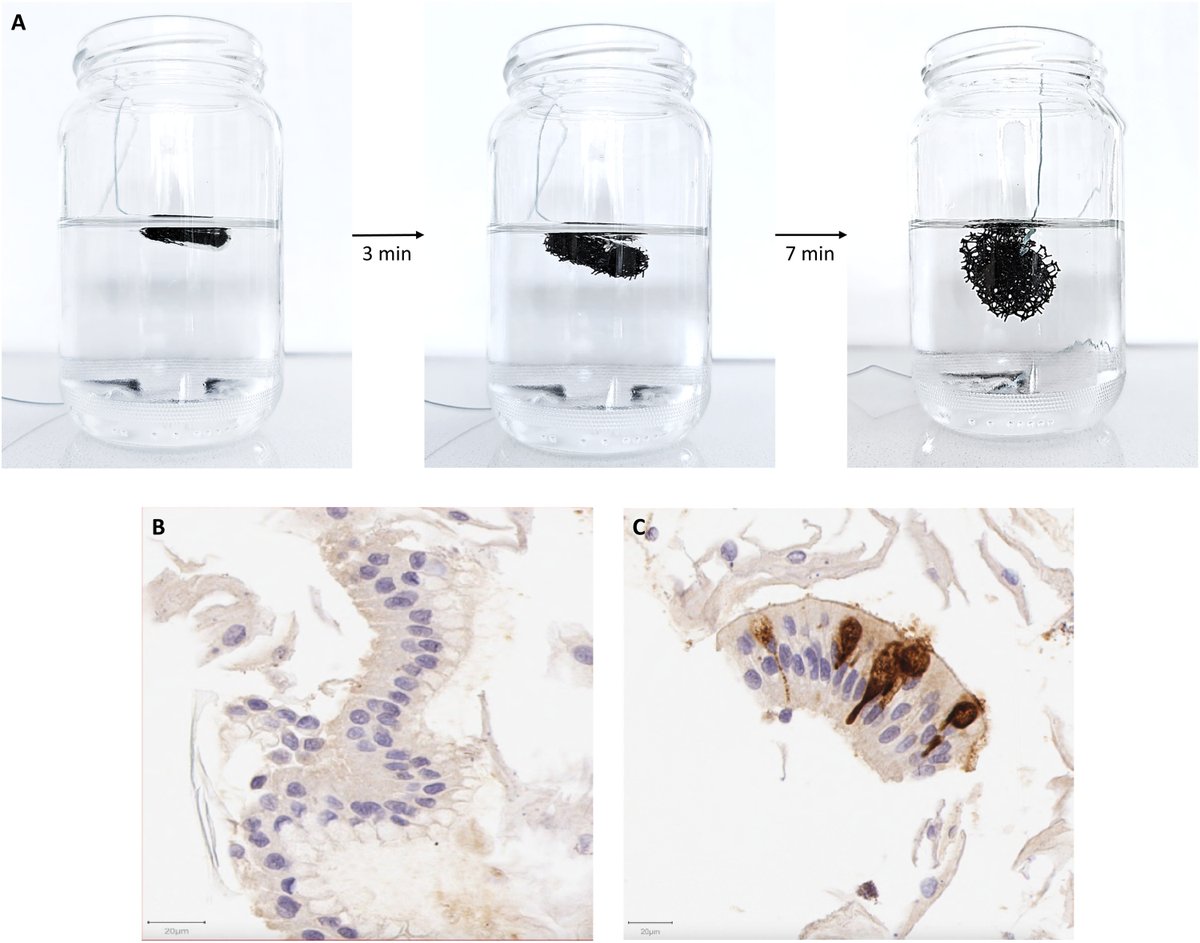 The Horizon of Screening for #Barrett'sEsophagus and #EsophagealCancer ow.ly/KAOO50OtBJK @VinayChandraMD @EHolzwanger @AbiMansourMD @DrWKTan @RFitzgerald_lab