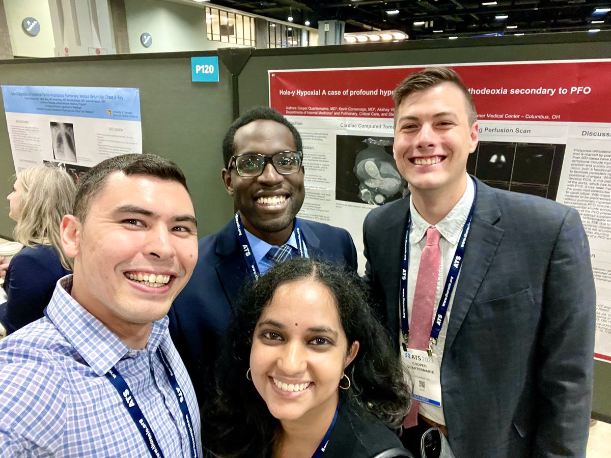Shilpa Sridhar, MD (@shilpasridharmd) on Twitter photo <a href="/OSUMedPedsRes/">Ohio State Med-Peds Residency</a> and <a href="/OhioStateIMRes/">Ohio State Internal Medicine Residency</a> at #ATS2023! Featuring <a href="/Cooper_25maine/">Cooper Quartermaine, MD</a>’s poster about a case of a significant PFO <a href="/MatthewJBarraza/">Matthew Barraza</a> <a href="/temiolojo/">Temitayo Olojo</a> <a href="/OSUMedPedsRes/">Ohio State Med-Peds Residency</a> and <a href="/OhioStateIMRes/">Ohio State Internal Medicine Residency</a> at #ATS2023! Featuring <a href="/Cooper_25maine/">Cooper Quartermaine, MD</a>’s poster about a case of a significant PFO <a href="/MatthewJBarraza/">Matthew Barraza</a> <a href="/temiolojo/">Temitayo Olojo</a>