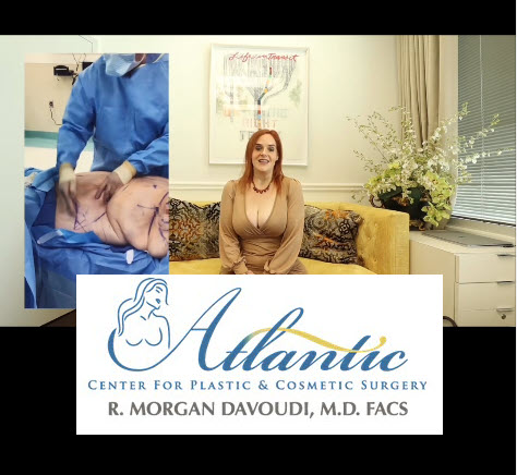 Currently we are offering FREE Consultations..... Call or email today myatlantaplasticsurgeon.com #plasticsurgeon #atlanta #plasticsurgery