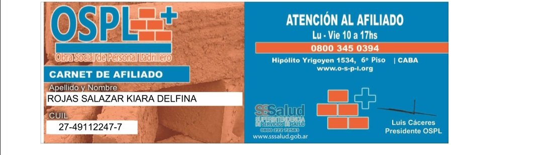 milidsalazar's tweet photo. #AYUDA kiara nec3sita operarse y la Obra social del personal de ladrilleros no responde al pedido del material quirúrgico.#OsLp
@marielfmoreno1 @MovimientoEvita @chino_navarrook @ComunesArg @daiana_anadon @lisdiazok @Kicillofok @Diputados_Todos @UTEPoficial @gaba_cala @ludeponti https://t.co/hsCKIzv866