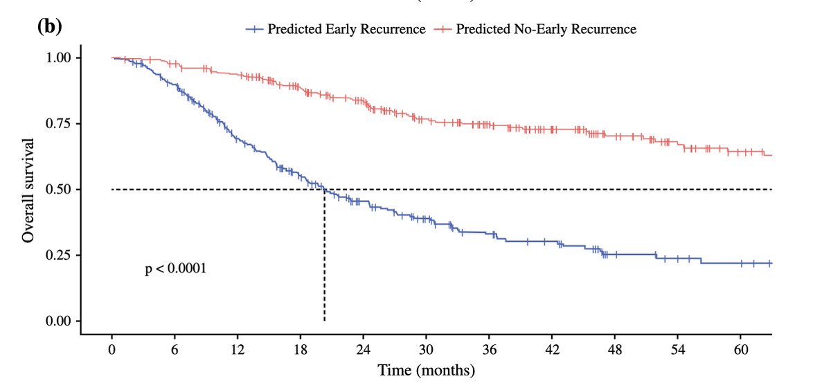 LauraAlaimo5's tweet photo. 🤖 AI prediction of early recurrence after resection of #intrahepatic #cholangiocarcinoma 
‼️Interact with the online calculator https://t.co/G1Or8LXlrO 
Thanks to our great mentor @timpawlik and the best team @ZoraysM @HLimaSurg @YutakaEndoSurg 

➡️ https://t.co/eSVJafLoK1 https://t.co/ysKG3dBO8k