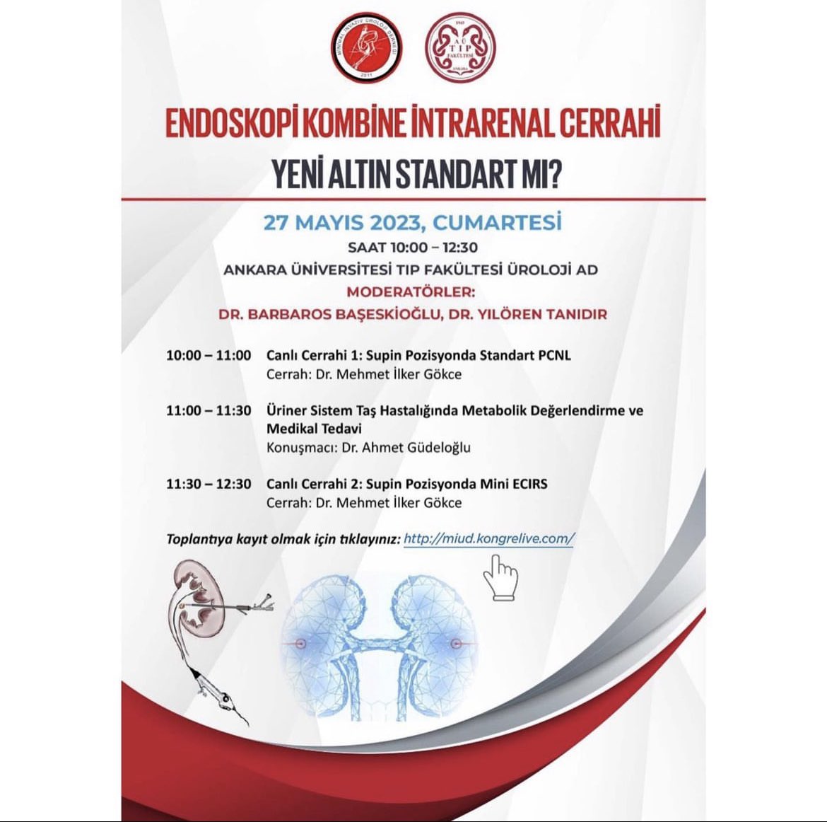 Mehmet Ilker Gökce (@migokce) on Twitter photo ❇️ Live Surgery - ECIRS & Supine PCNL
🗓️ May 27, Sat, 10:00 AM (GMT +3)
👉🏻 For registration 👇🏻
miud.kongrelive.com
<a href="/MIUD_DERNEGI/">Minimal İnvaziv Üroloji Derneği</a>
<a href="/barbaroza/">Barbaros Baseskioglu</a> <a href="/ytanidir/">Yiloren Tanidir</a> <a href="/gudeloglu_a/">Ahmet Gudeloglu</a> ❇️ Live Surgery - ECIRS & Supine PCNL
🗓️ May 27, Sat, 10:00 AM (GMT +3)
👉🏻 For registration 👇🏻
miud.kongrelive.com
<a href="/MIUD_DERNEGI/">Minimal İnvaziv Üroloji Derneği</a>
<a href="/barbaroza/">Barbaros Baseskioglu</a> <a href="/ytanidir/">Yiloren Tanidir</a> <a href="/gudeloglu_a/">Ahmet Gudeloglu</a>