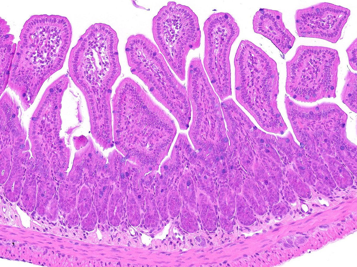 scisignal's tweet photo. Researchers identify a strain of #Bcereus that disturbs the intestinal epithelium and damages cell junctions by secreting alveolysin, which they found increases CFAP100 and disrupts microtubule networks. #HostPathogenInteractions https://t.co/OFZmCQkaGF https://t.co/zWj6gg4nV1