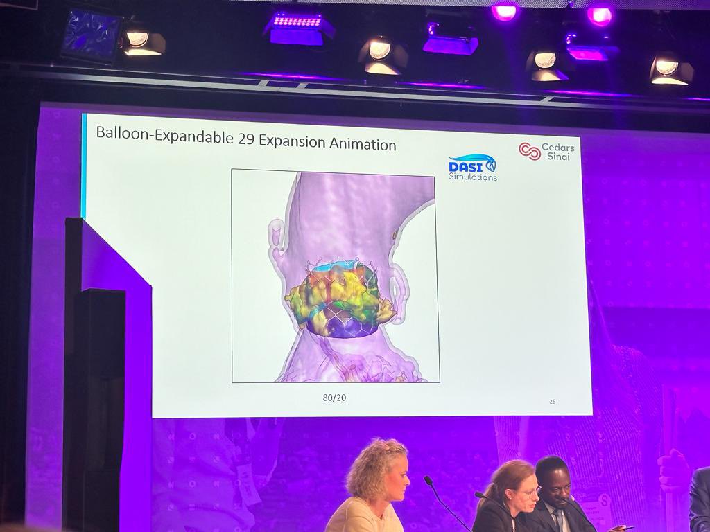 teri_sirset's tweet photo. Thank you @RajMakkar and @HasanJilaihawi for showcasing @DASISimulations at #EuroPCR and highlighting how our  #oneofakind #AI #simulation #technology is used for #TAVR in #bicuspid patients. Younger and low risk patients need #lifetimemanagement @CedarsSinai @VinodThourani https://t.co/MizQfZvKdA