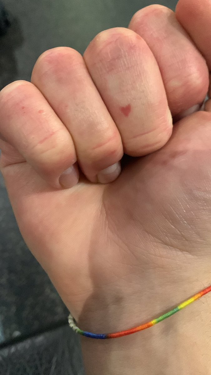 carlsperk's tweet photo. da like a la dermatitis en forma de corazón para aprobar todos tus exámenes https://t.co/OzGiNXONFA