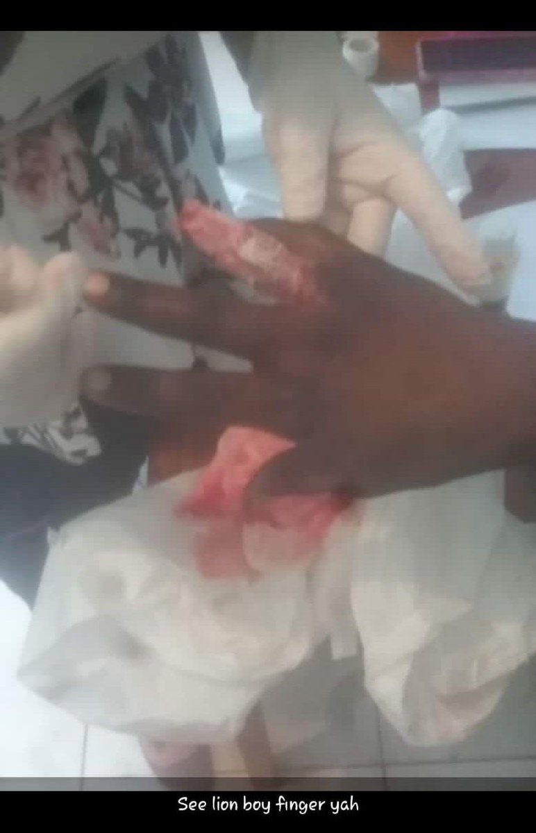 factor_JA's tweet photo. @MoreCrazyClips The Aftermath.🤦🏾‍♂️ https://t.co/AFPxsHrZDX