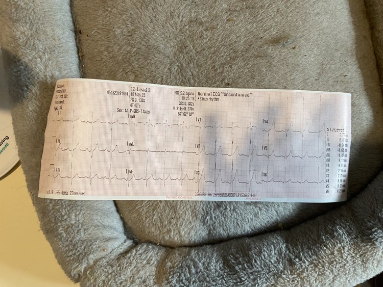 mhtn_Mongol_Bun's tweet photo. I've just been sent this. Here are my ECGs from the 3rd and 4th ER trip, the 4th being the h/a. Here's my blood pressure from after the fight, with my name signed on it. Lying about your medical condition my ASS, you sociopath. @CarnSodawasser https://t.co/JGZpZkQ0Qw