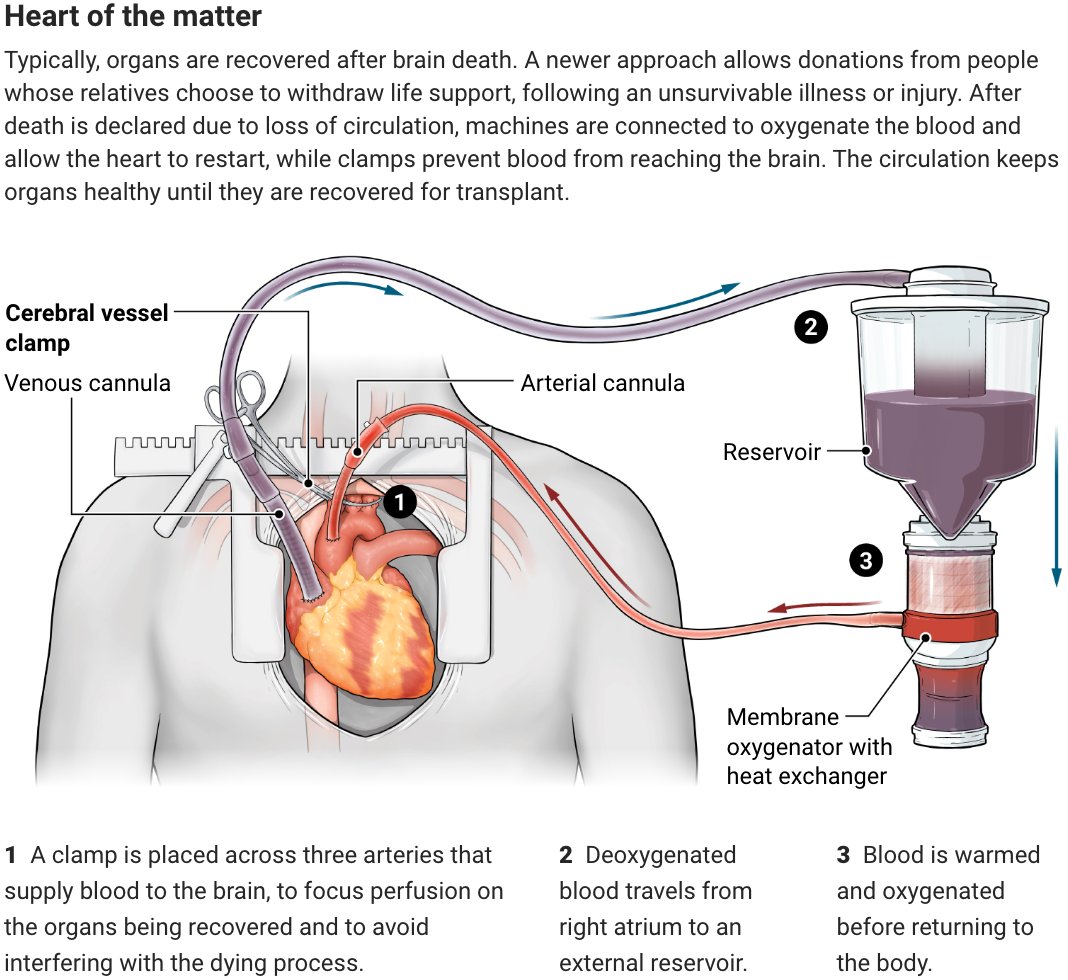 Science Magazine (@sciencemagazine) on Twitter photo A new procedure for donating hearts and other organs is saving lives. But for some, it challenges the definition of death.
Learn more in this <a href="/NewsfromScience/">News from Science</a> feature: scim.ag/2I5 A new procedure for donating hearts and other organs is saving lives. But for some, it challenges the definition of death.
Learn more in this <a href="/NewsfromScience/">News from Science</a> feature: scim.ag/2I5