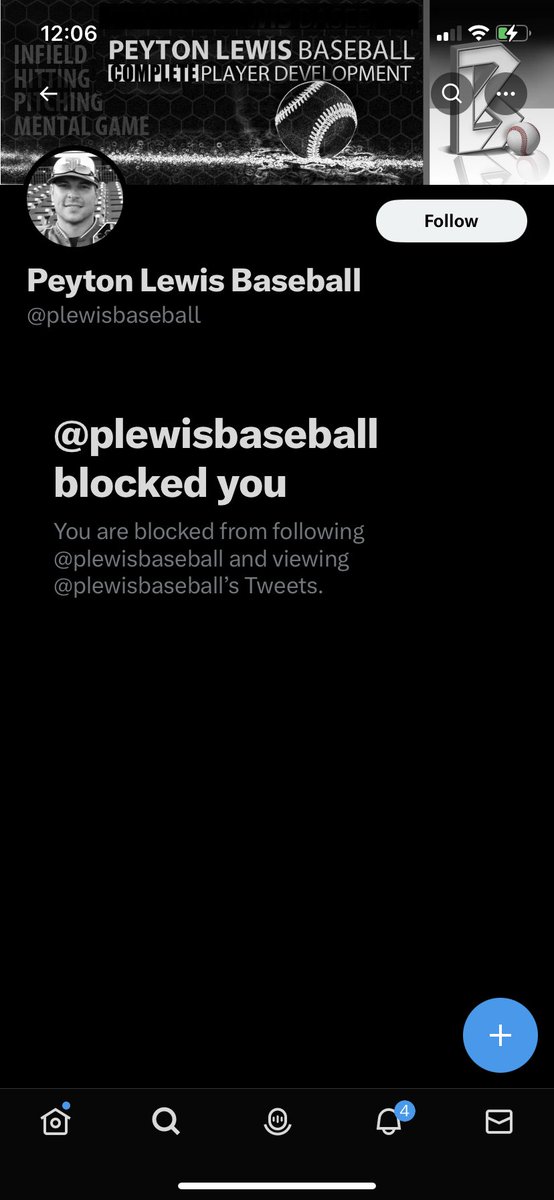 I think his feelings are hurt
