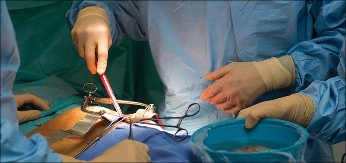 Nephrology19's tweet photo. #Kidney #transplant gives #woman second chance at #life after 6-year wait
Read more: https://t.co/MoOUWl7Rnf
submit your paper on https://t.co/CCrZyK5v8U
#kidney #transplant
#oain
#Manuscript
#research
#uk https://t.co/OyC5uwPGhn