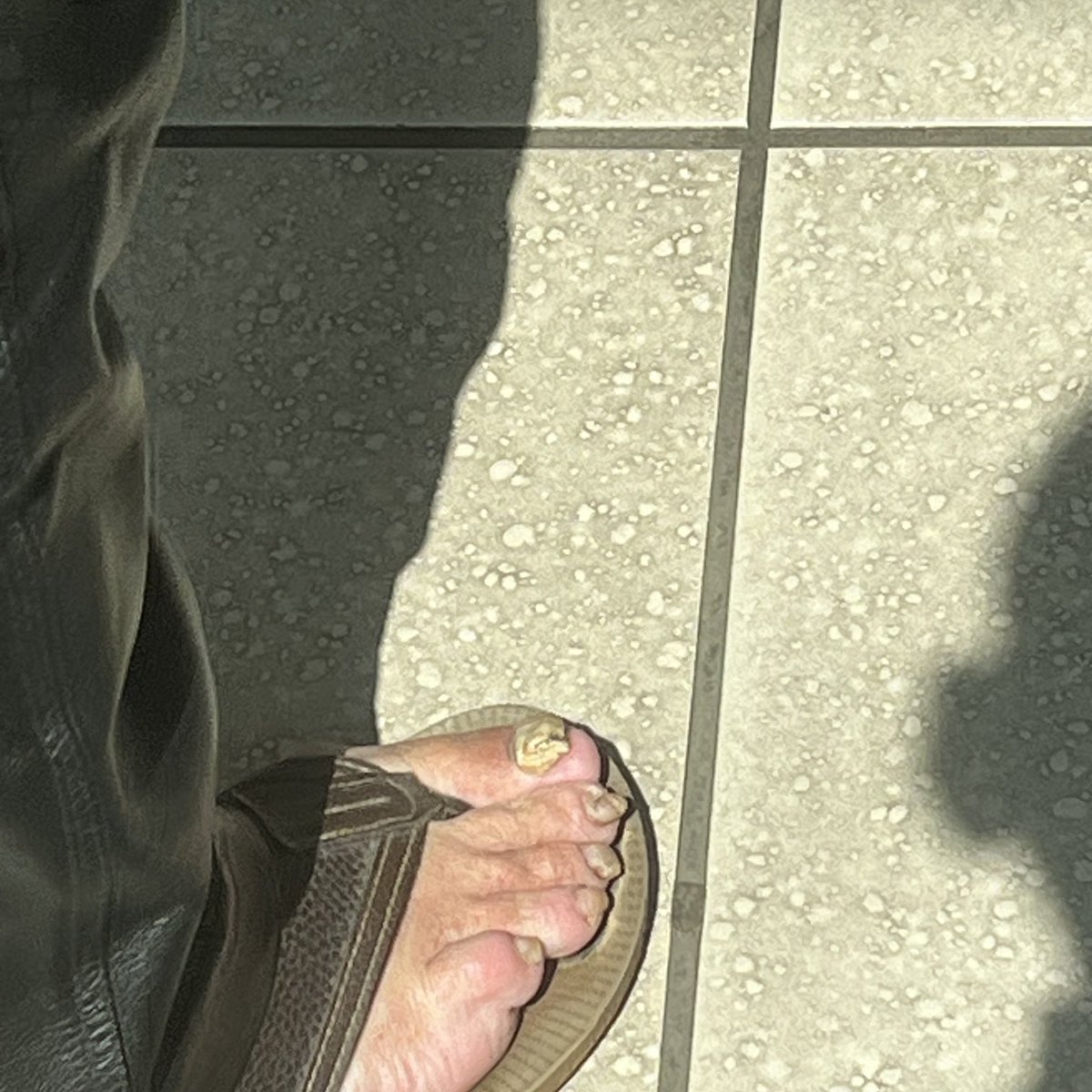 if this bare foot, you can keep it🤮