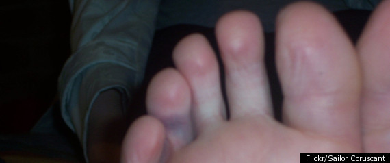 Dog eats man’s toes as he sleeps bit.ly/41QhBgH