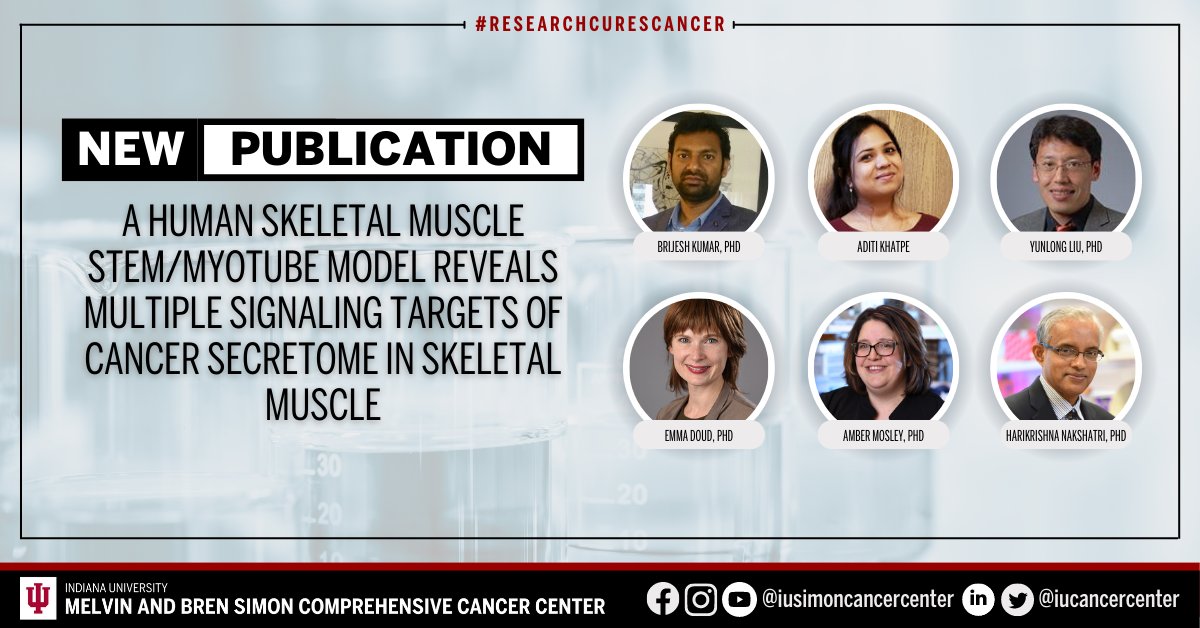 IU Simon Comprehensive Cancer Center (@iucancercenter) on Twitter photo Learn from a new article published in <a href="/iScience_CP/">iScience journal</a> by the cancer center's Drs. <a href="/yunlongliu/">Yunlong Liu</a>, <a href="/fireinlab/">Emma Doud @fireinlab@nerdculture.de</a>, @MosleyLab, Harikrishna Nakshatri, and our trainees Brijesh Kumar, PhD, Aditi Khatpe, and colleagues. Read more: ow.ly/1HsN50OfcxB. #ResearchCuresCancer #NCIcomprehensive Learn from a new article published in <a href="/iScience_CP/">iScience journal</a> by the cancer center's Drs. <a href="/yunlongliu/">Yunlong Liu</a>, <a href="/fireinlab/">Emma Doud @fireinlab@nerdculture.de</a>, @MosleyLab, Harikrishna Nakshatri, and our trainees Brijesh Kumar, PhD, Aditi Khatpe, and colleagues. Read more: ow.ly/1HsN50OfcxB. #ResearchCuresCancer #NCIcomprehensive