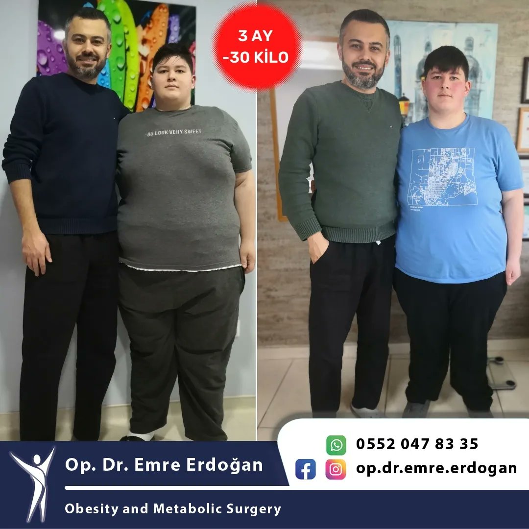 obircerrah's tweet photo. #obezite #obesity #gastricbaloon #obesitysurgery #sleevegastrectomy #tupmideameliyati https://t.co/KvC8SaKjjT