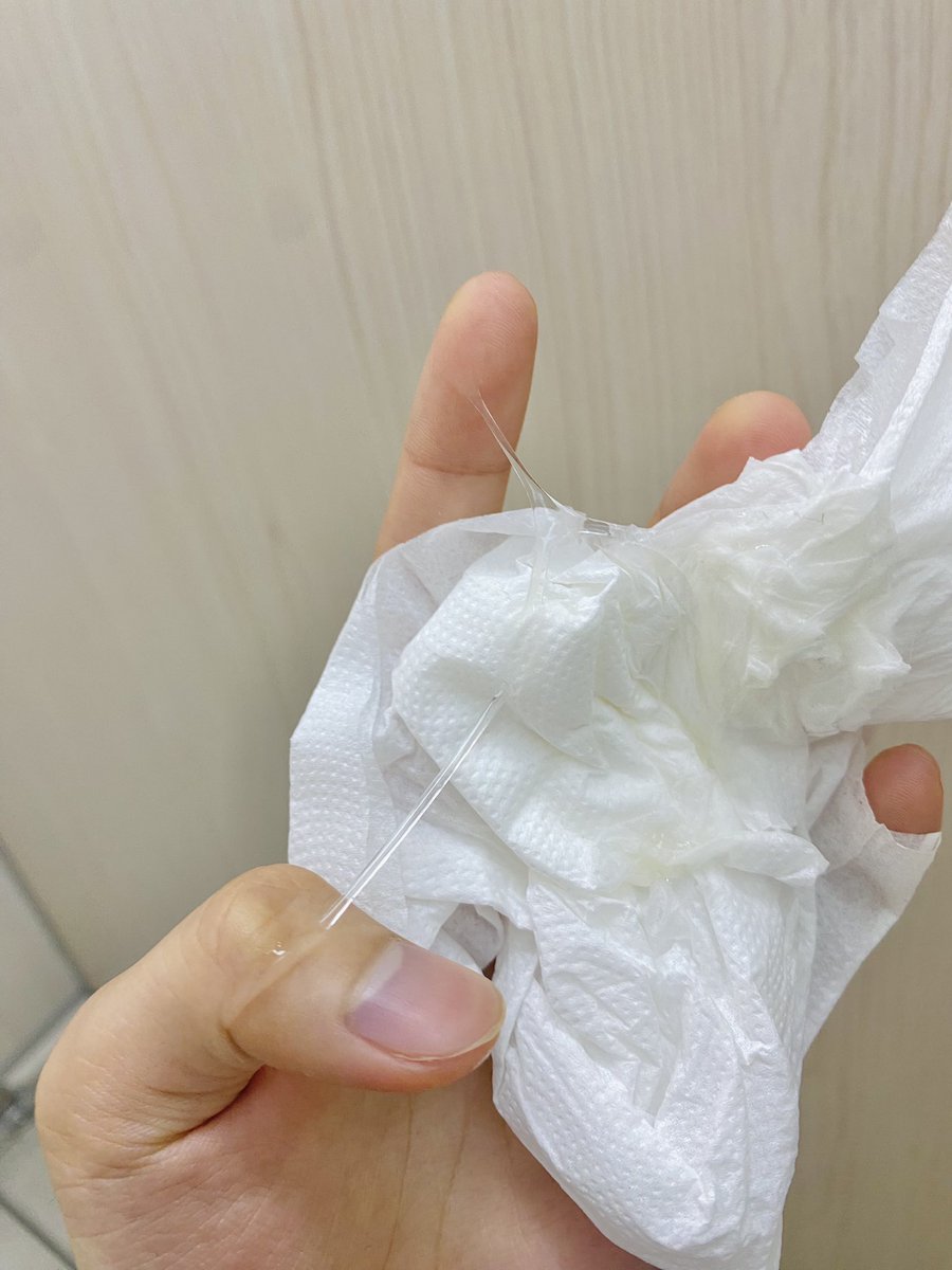 imokaeru_'s tweet photo. 這幾天的分泌物也太爆多ㄌ⋯ https://t.co/3KiUfmdaxq