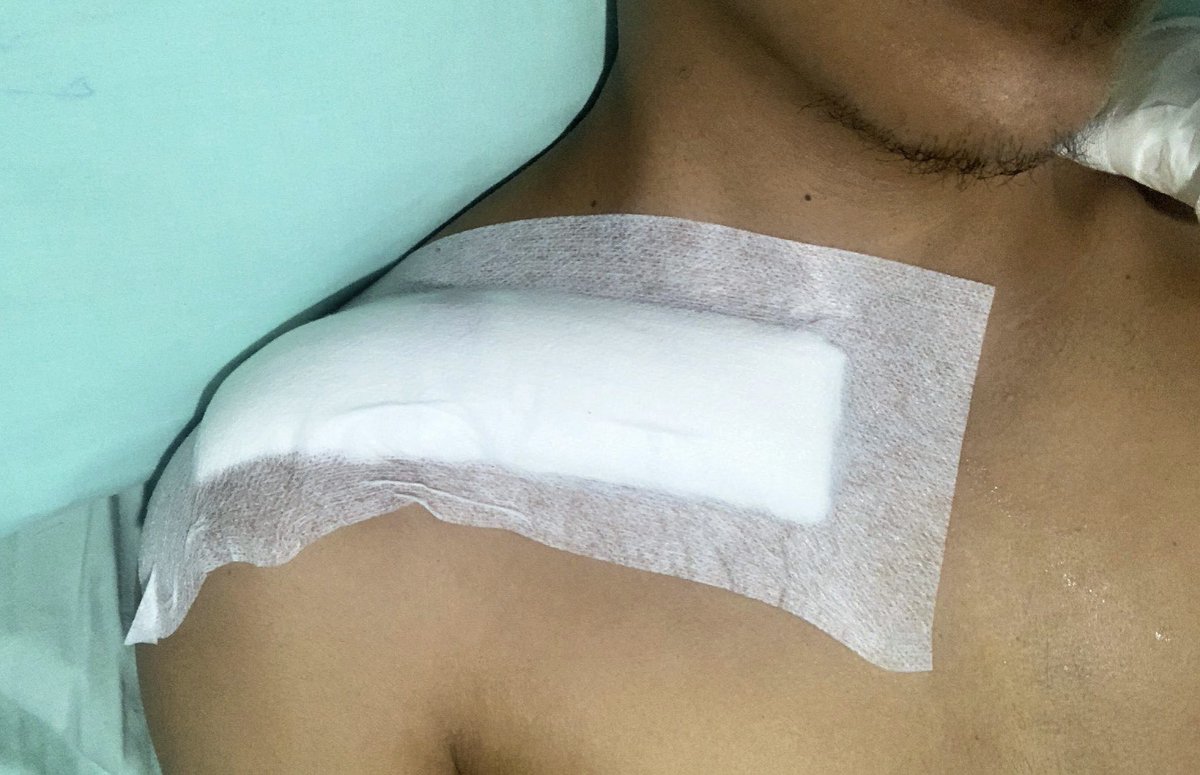 Once in a lifetime experience 🦴