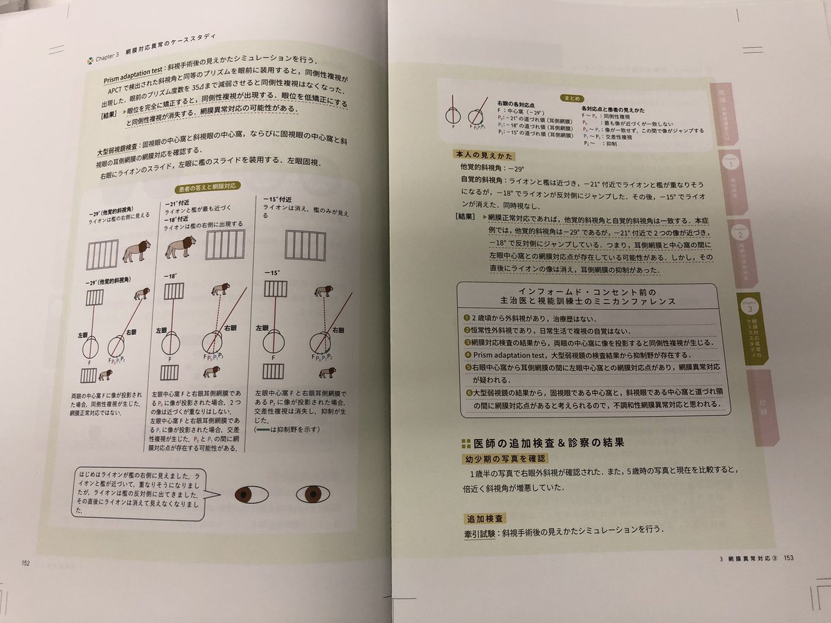 miwashoten_gnk's tweet photo. 『できる！斜視検査』のプルーフ校正が出ました。これから最終校正です。

「ちょっとおせっかいだけど、みんながわかる斜視検査」がコンセプトの本です。
ニッチでマニアックですが、こんなにわかりやすく説明されている斜視検査の書籍は本邦初かもしれません。
特に視能訓練士さんにはおすすめです！ https://t.co/dPyG8OlDCZ
