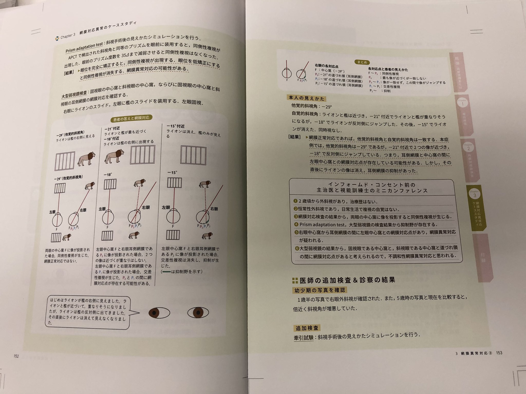 できる!斜視検査両眼視機能がわかる,ケーススタディでレベル