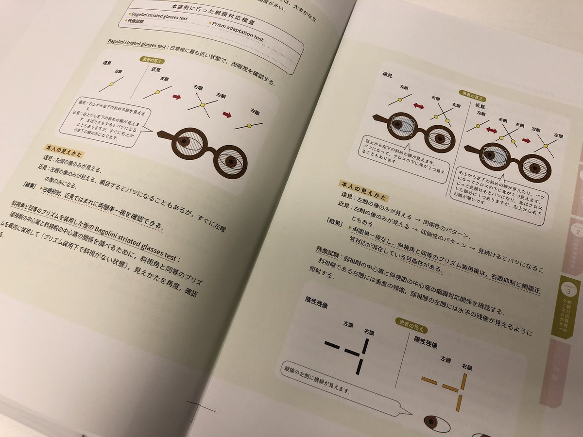 miwashoten_gnk's tweet photo. 『できる！斜視検査』のプルーフ校正が出ました。これから最終校正です。

「ちょっとおせっかいだけど、みんながわかる斜視検査」がコンセプトの本です。
ニッチでマニアックですが、こんなにわかりやすく説明されている斜視検査の書籍は本邦初かもしれません。
特に視能訓練士さんにはおすすめです！ https://t.co/dPyG8OlDCZ