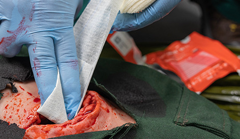 #DidYouKnow ChitoGauze® XR PR chitosan-impregnated product provides life-saving actions when seconds matter and is derived from a naturally occurring, biocompatible polysaccharide that is designed to control moderate to severe hemorrhage... Read more: hubs.la/Q01NXD2l0