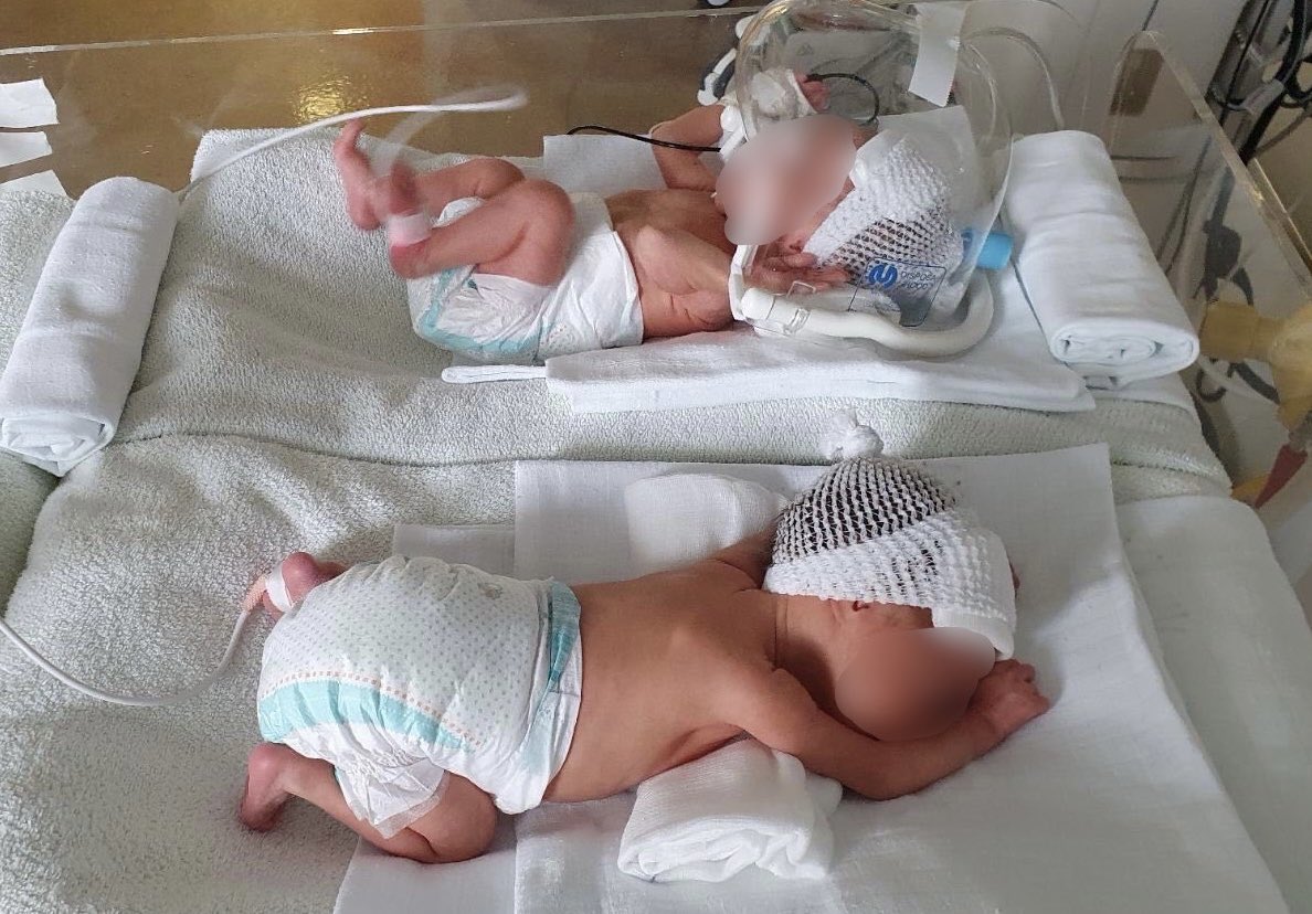 isak_arnel's tweet photo. Prvi rođendan naših blizanaca, Dalie i Davuda

23.maj 2022. godine na nas je ostavio neizbrisiv trag i jedno veliko životno iskustvo.

Dalia i Davud su prijevremeno rođene bebe koje su svoje prve dane života morale provesti u bolnici u Sarajevu. Bio je to jedan težak i stresan period.

Sama neizvjesnost je ono što čovjeku najteže pada, ali svjesni činjenice da sve što se dešava dolazi od Boga čvrsto smo vjerovali da će sve biti dobro. 

Vjerovali smo i u konačnici bili u pravu.

Svi ti događaji samo su nas još više povezali i približili.

Sada smo jedna mnogobrojna i sretna porodica koja je  ponosna na naše malene heroje, na naša najmanja, a najhrabrija srca.

Djeco naša sretan vam prvi rođendan!