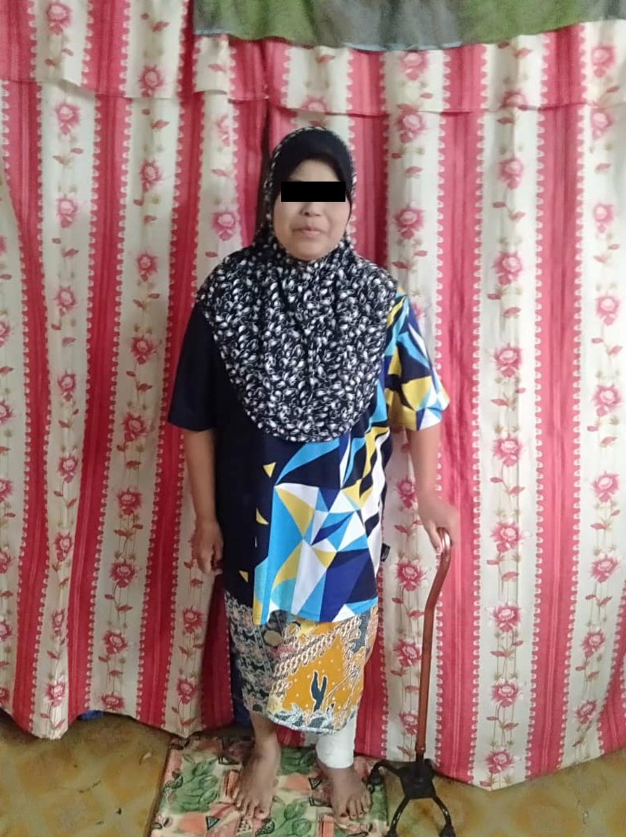 MarhaenMy's tweet photo. Haritu ada orang DM aku, minta tolong utk makcik ni. Makcik ni kaki dia luka teruk, patutnya kena buat dressing tiap minggu tapi lama tak tukar sbb takda duit nak beli barang utk dressing kaki dia. 

Kita cuba tolong makcik ni pulak. Mana tahu ada rezeki utk dia. Tulun RT gais 🙏 https://t.co/VXMFJ92G65