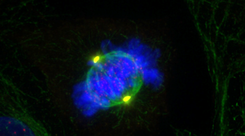 CSICCat's tweet photo. Revelan mecanismo que regula la dineína, motor molecular clave en división celular y desarrollo neuronal
El estudio, liderado por @IBMB_CSIC, puede ayudar en investigación de patologías #neuronales y causados por problemas #desarrollo
https://t.co/TZlGfbFo5u https://t.co/z9Bdv6lT6H