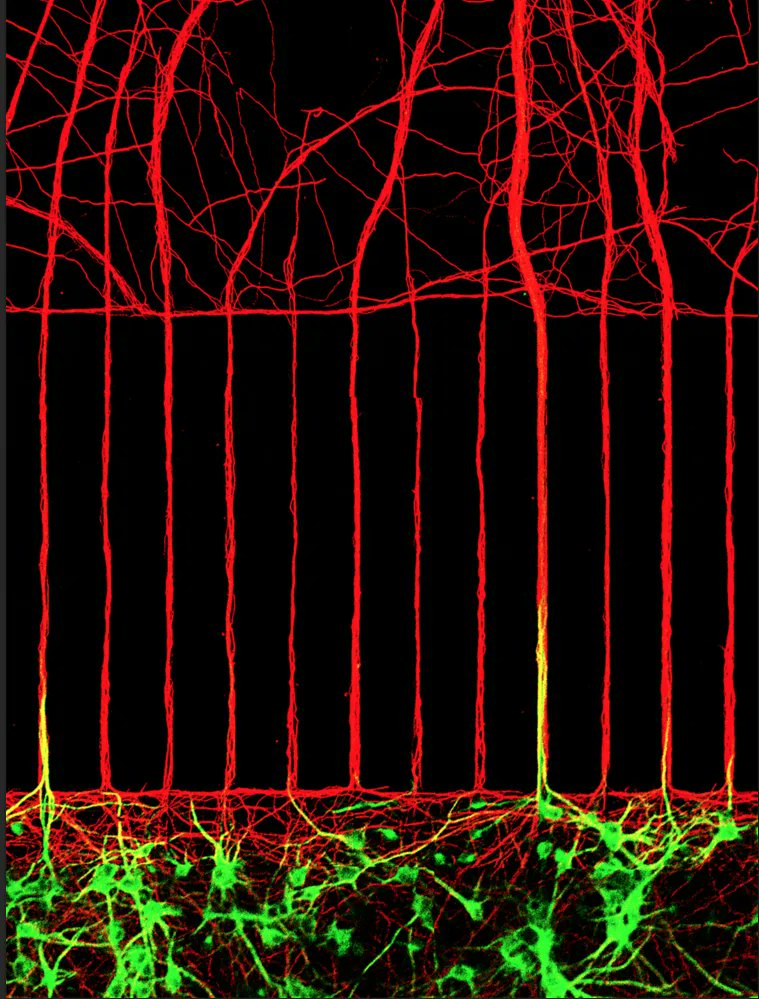 Pretty neuronal trees.  

Credits: Pamela J. Yao, 

#neuroscience