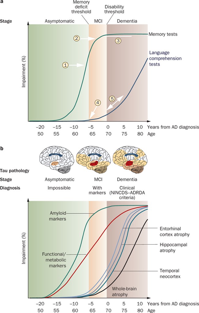 chrost_hugo's tweet photo. Natural progression of cognitive and biological markers of Alzheimer disease: a theoretical model.  

Source:@Nature

#MedTwitter https://t.co/UWuYxxCe6L