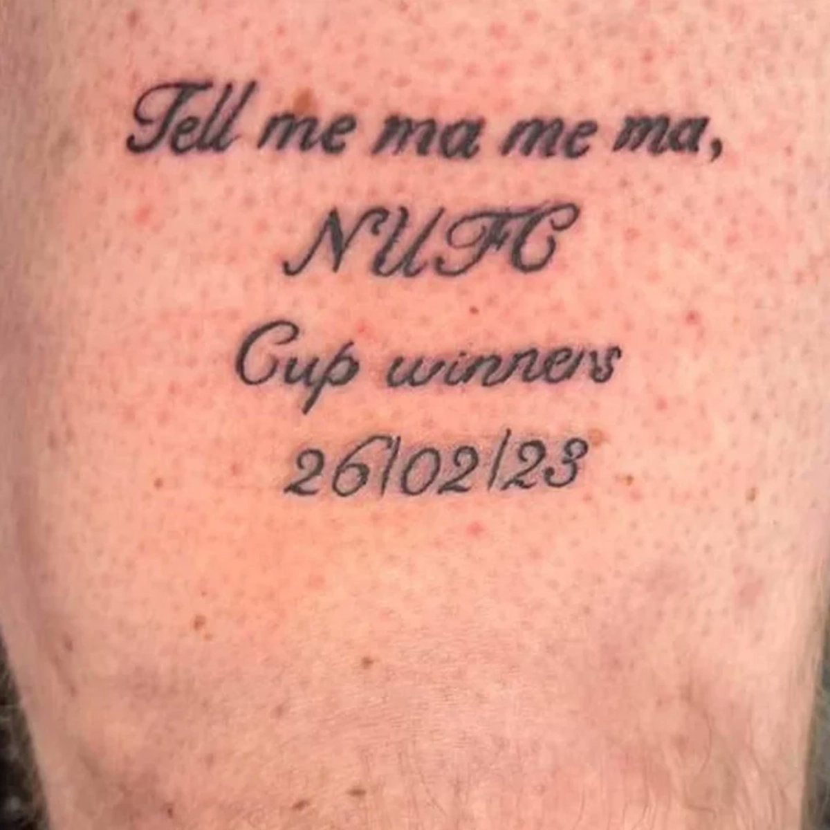 Men in Blazers on X: "Man City fan gets Treble Ink ahead of Saturday's final against Inter. Chances it will be second 2023 entry in English Football Tattoo Hall of Fame? ✒️