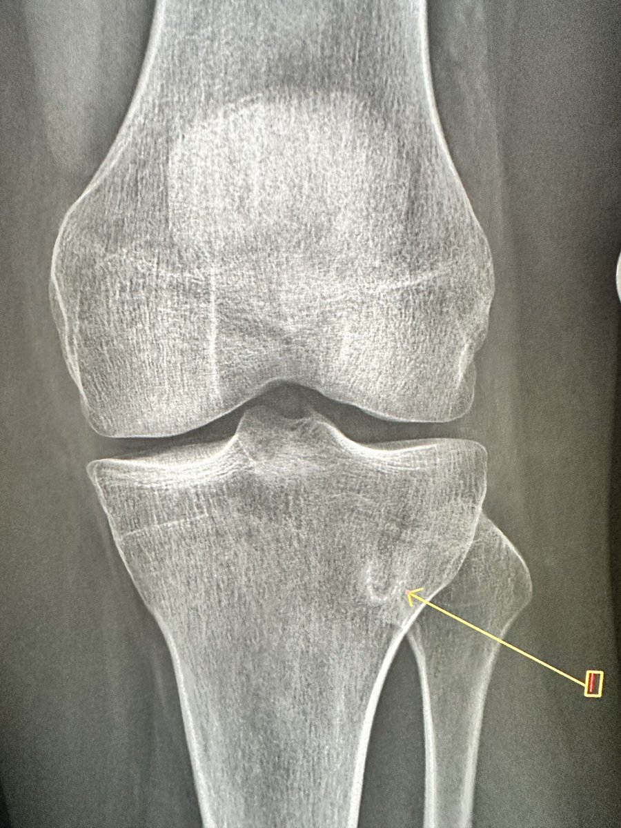 M. Skalski on Twitter: