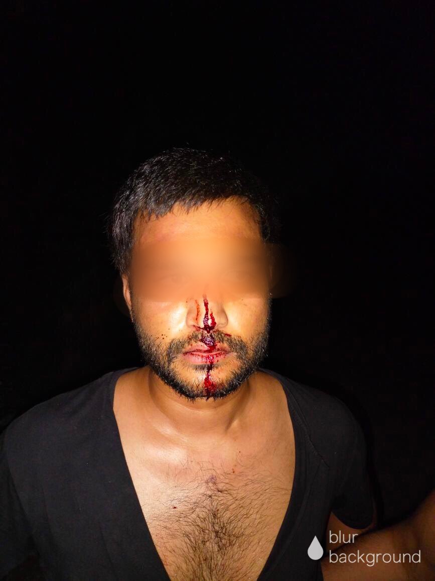 Doctors are safe neither inside hospitals nor inside their hostels 

Brutality reached its peaks in the hostels of GIMS medical college in greater Noida where students were Beaten with Rods , Thrashed ,their property was destroyed publicly by security guards and local people.