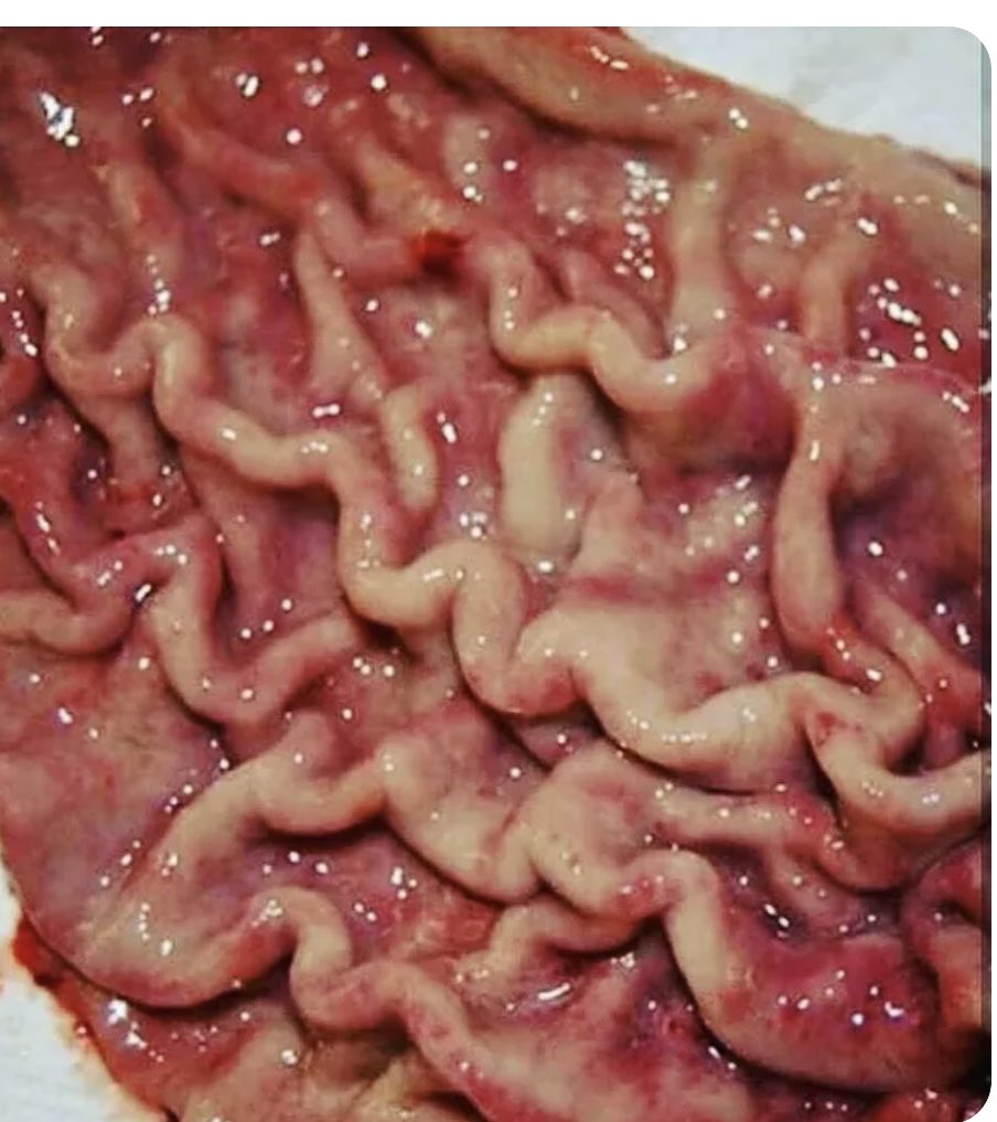 Oren Gottfried, MD tweet media