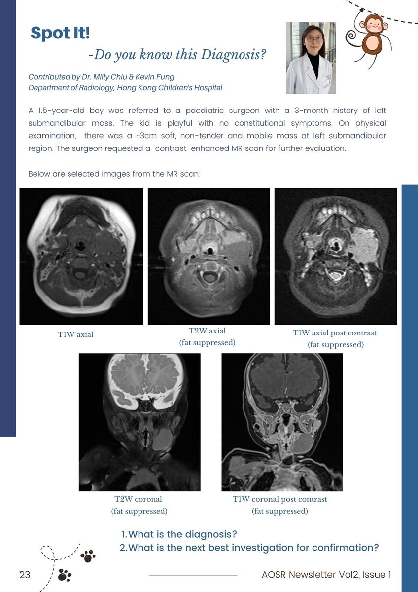 Kevin Fung (@irhkch) on Twitter photo Happy to bring you the newsletter of Asia-Oceanic Soc of Radiology as its editor 🤓
We have a good representation of #PedRad in this issue 👶🏻🩻
& if you haven’t registered yet, early bird for <a href="/AOSPRhk2023/">AOSPR 2023</a> is ending on 15th Jun!! 🇭🇰🥟🐉
Full version: theaosr.org/bbs/skin/defau… Happy to bring you the newsletter of Asia-Oceanic Soc of Radiology as its editor 🤓
We have a good representation of #PedRad in this issue 👶🏻🩻
& if you haven’t registered yet, early bird for <a href="/AOSPRhk2023/">AOSPR 2023</a> is ending on 15th Jun!! 🇭🇰🥟🐉
Full version: theaosr.org/bbs/skin/defau…