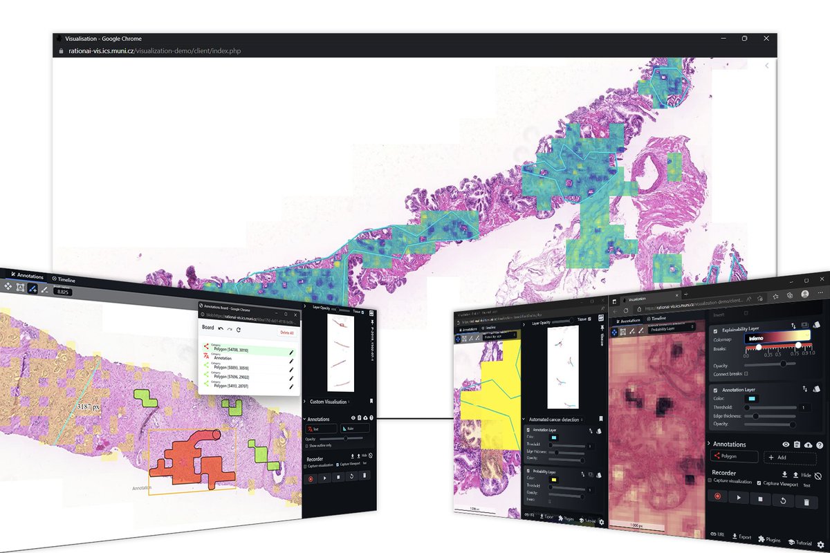 EuroVisConf's tweet photo. π Unlock the potential of histopathology research with xOpat: the versatile WSI viewer empowering collaboration and discovery.
βοΈ J. Horak,β―@katka_furmanova,β―@bara_kozlikova, @ByskaJan, @vitek_r et al.
π https://t.co/TvJ616NUP9
#Fullpaper #EuroVis #Eurovis2023 https://t.co/A3dqnIvAk5
