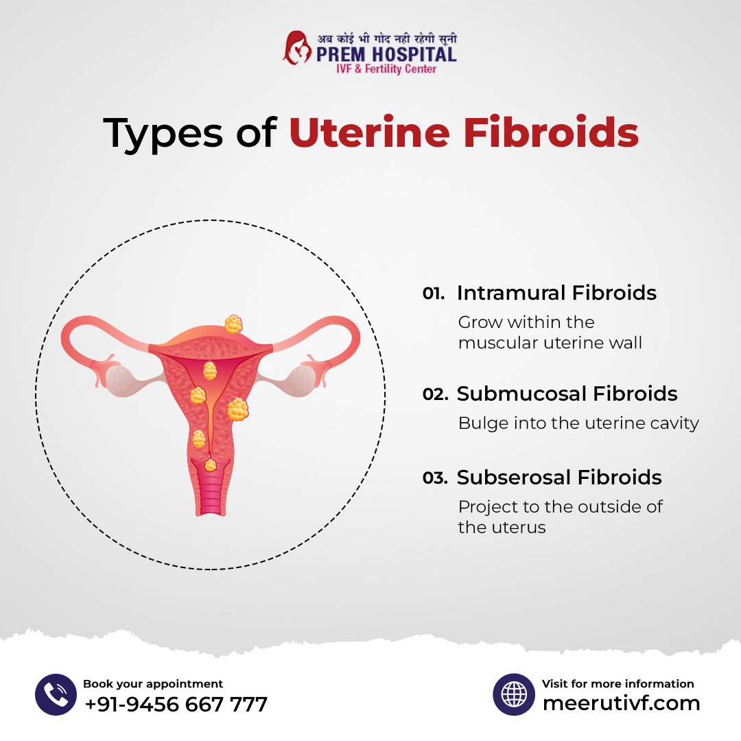 KNOW YOUR UTERINE FIBROIDS! Understanding the types can empower you. Educate yourself about these variations for better awareness and management.

#ivf #IVFclinic #ivfinmeerut #fertilityclinic #infertilitytreatmentmeerut #pregnancyjourney #infertility #IVFtreatment #IUI #ICSI